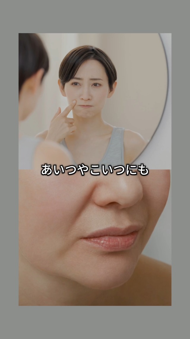 Amazon.co.jp: WAVEWAVE 脱毛器 光美容器 IPL NIR DPL VIO対応 メンズ